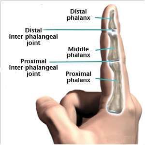 Unjamming a Jammed Finger - STARS Physical Therapy
